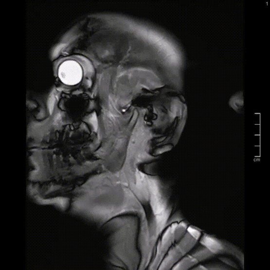 Ein MRT des Kiefergelenk in der Radiologie Nürnberg