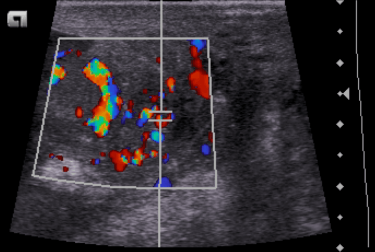 Ultraschall/Sonografie im Institut für Radiologie im Krankenhaus Martha-Maria Nürnberg Ultraschall/Sonografie im Institut für Radiologie im Krankenhaus Martha-Maria Nürnberg