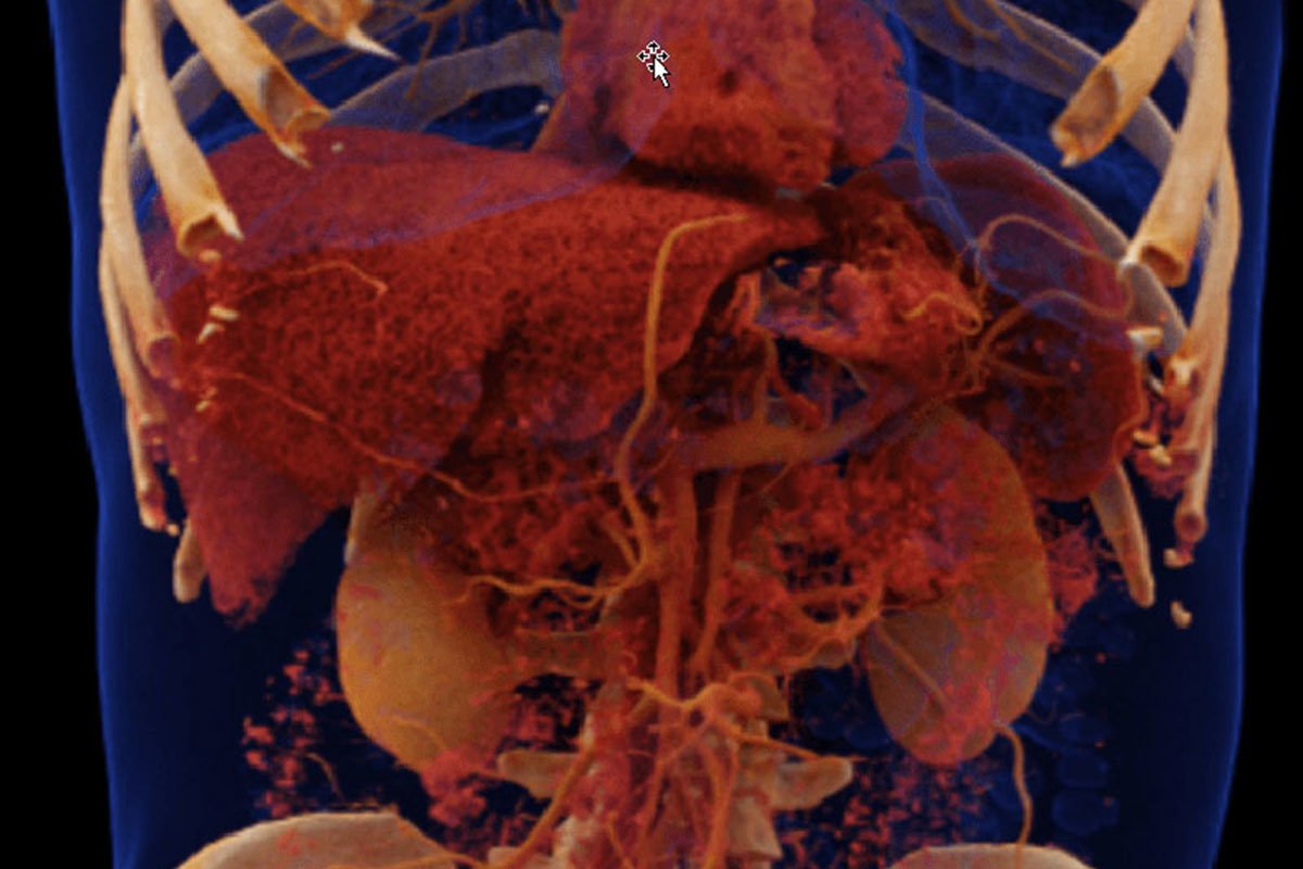 Computertomografie in der Radiologie Martha Maria Nürnberg Computertomografie