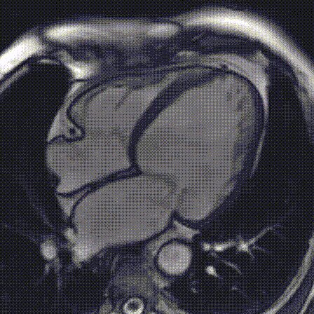 Ein Herz-MRT in der Radiologie Nürnberg