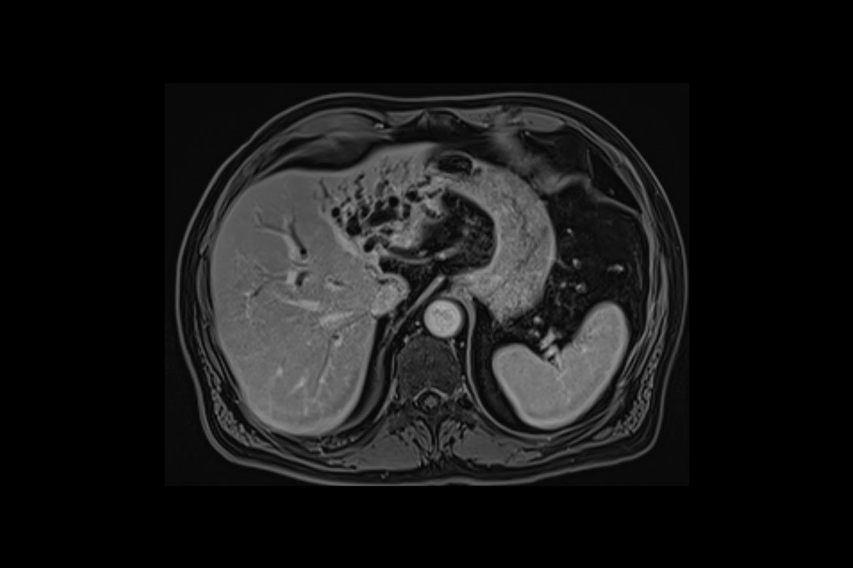 Vorsorge Bauchraum/Abdomen im Institut für Radiologie im Krankenhaus Martha-Maria Nürnberg Vorsorge Bauchraum