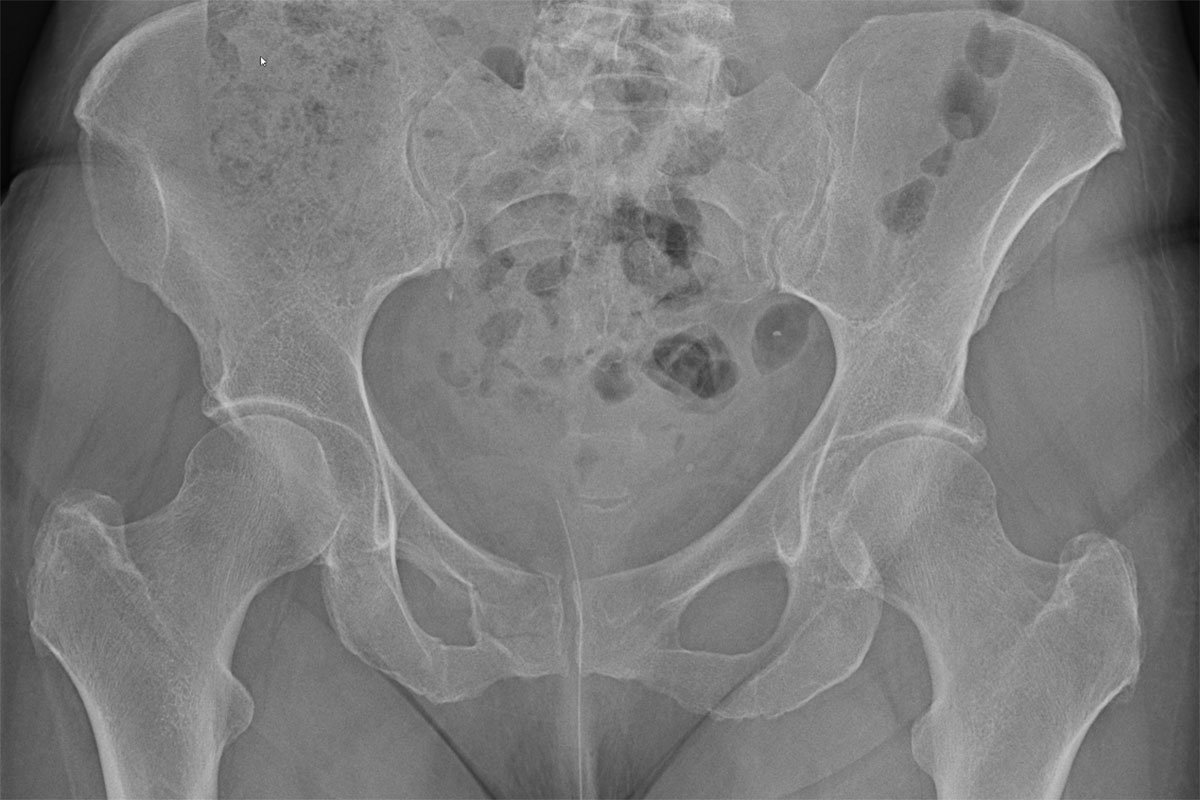 Röntgendiagnostik im Institut für Radiologie im Krankenhaus Martha-Maria Nürnberg Röntgendiagnostik