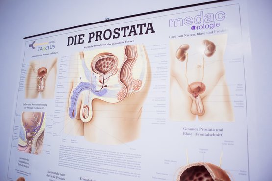 Die grafische Darstellung einer Prostata.