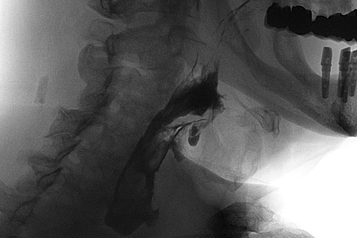 Durchleuchtung im Institut für Radiologie im Krankenhaus Martha-Maria Nürnberg Durchleuchtung