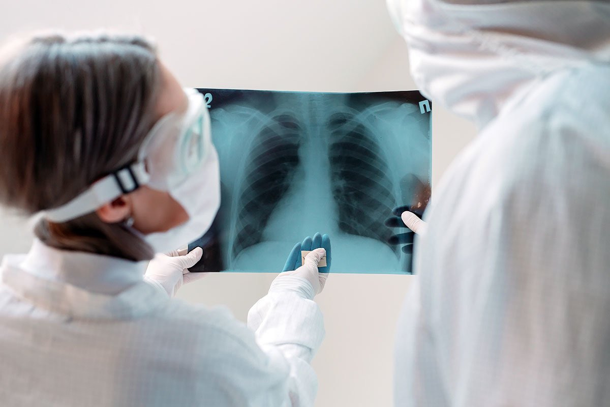 Lungenfibrose Diagnose und Therapie im MVZ Martha-Maria Lungenzentrum München Lungenfibrose