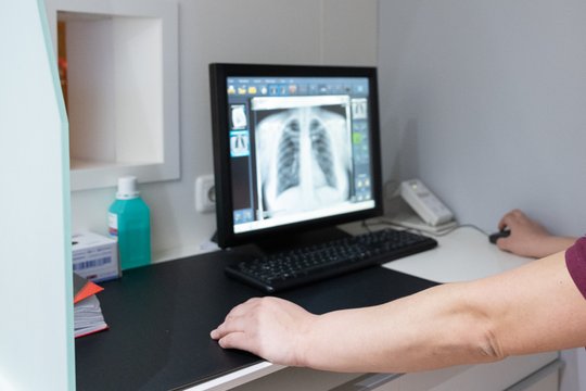 Medizinisches Personal analysiert Röntgenaufnahme in Lungenzentrum München.