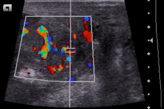 Eine Aufnahme aus dem Ultraschall