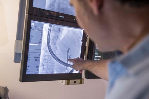 Arzt zeigt auf Röntgenbild, vermutlich endoskopisches Verfahren im Krankenhaus.