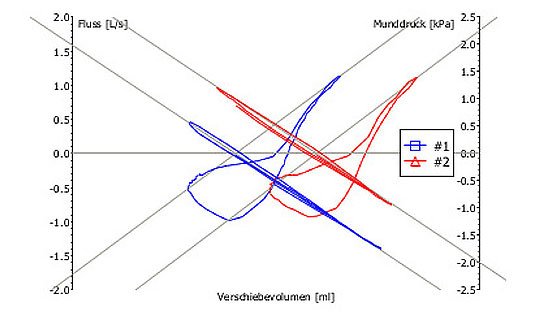 Typisches Bild einer Lungenfunktionsprüfung bei COPD