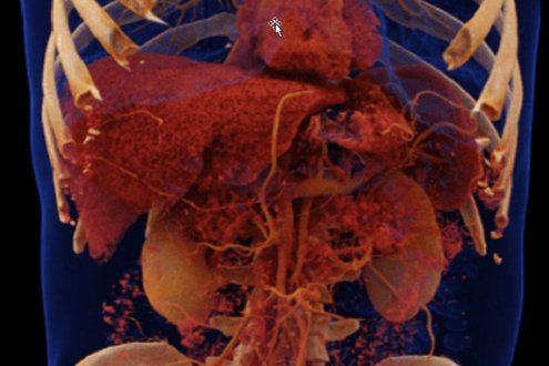 Computertomografie